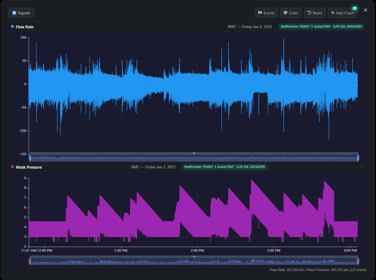 Charts View — multi-channel waveform viewer