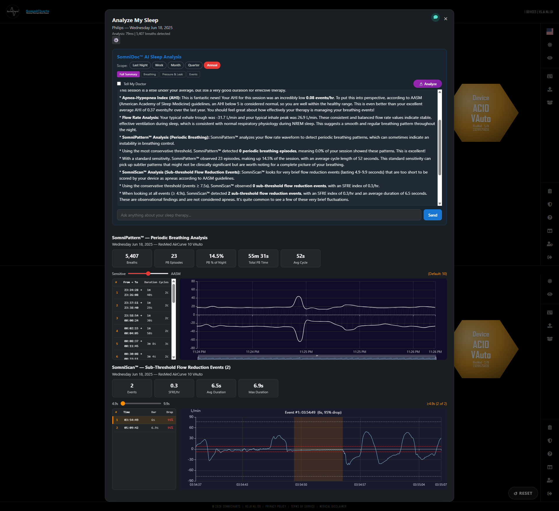 SomniDoc — 1-year analysis real screenshot