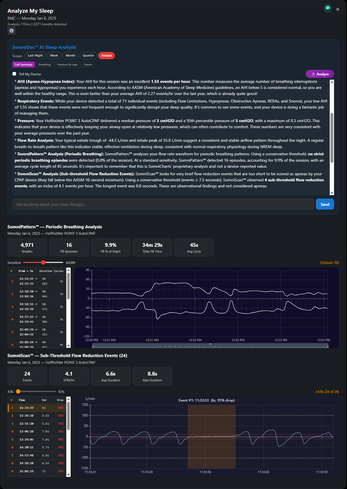 SomniDoc — single-night analysis real screenshot