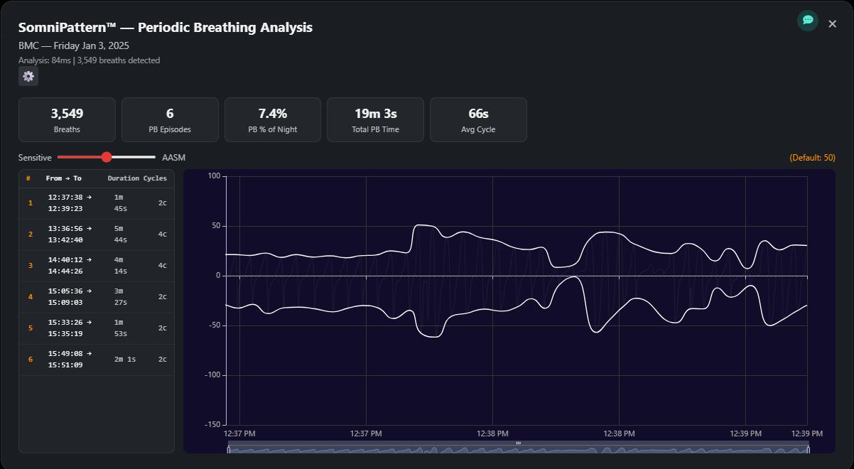 SomniPattern — periodic breathing detection