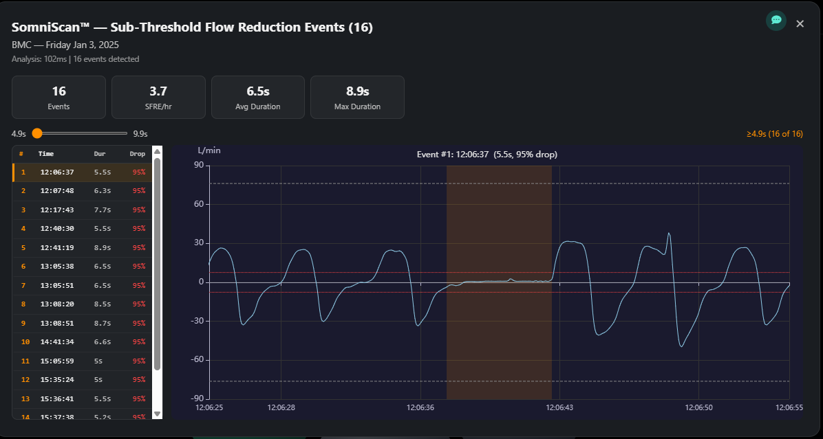 SomniScan — sub-threshold event detection